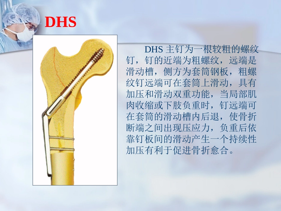 外科学：股骨转子间骨折的治疗：髓内or髓外_第15页