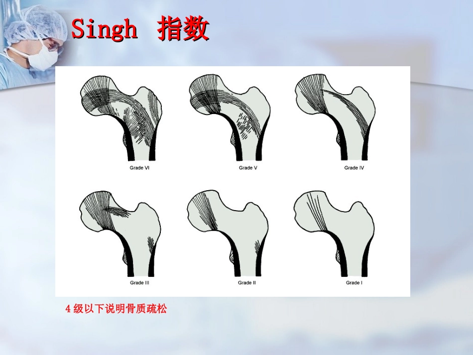 外科学：股骨转子间骨折的治疗：髓内or髓外_第7页
