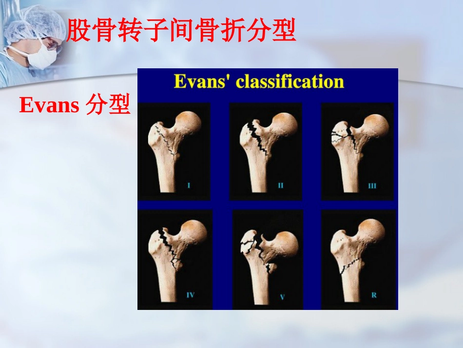 外科学：股骨转子间骨折的治疗：髓内or髓外_第8页