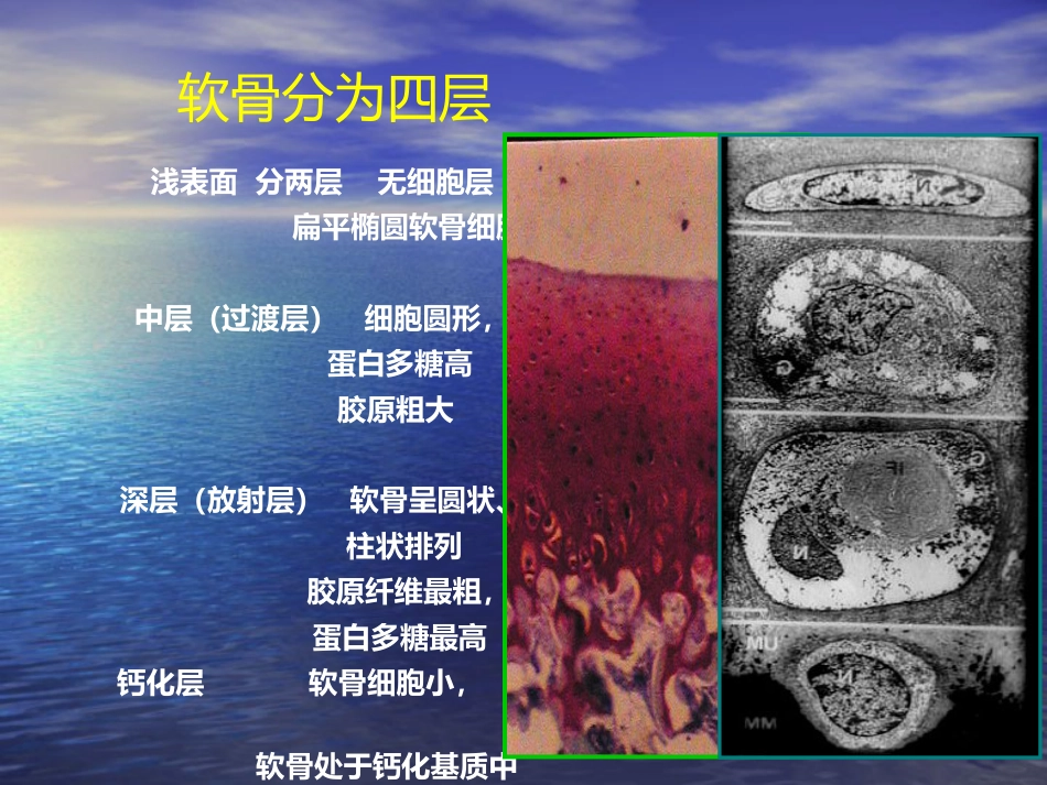 外科学：膝关节骨性关节炎的分级治疗_第14页