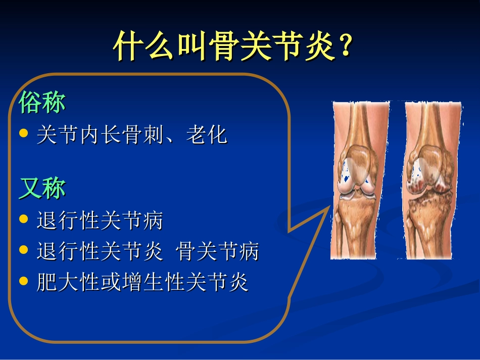 外科学：膝关节骨性关节炎的分级治疗_第2页