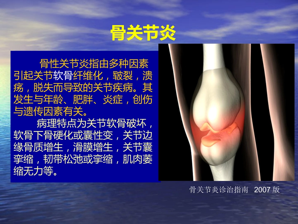 外科学：膝关节骨性关节炎的分级治疗_第3页