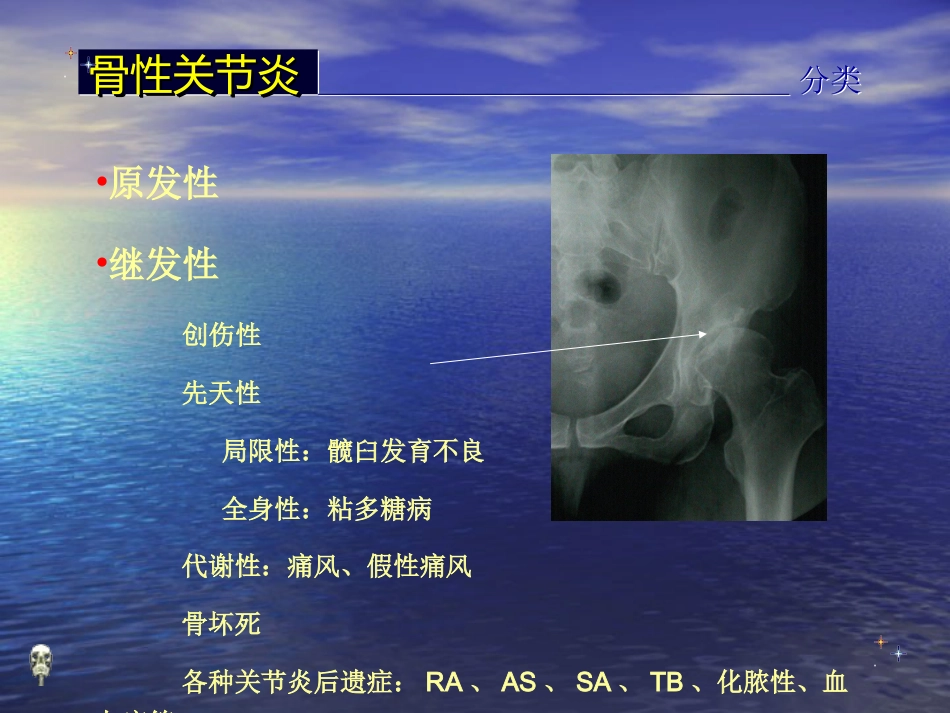 外科学：膝关节骨性关节炎的分级治疗_第4页