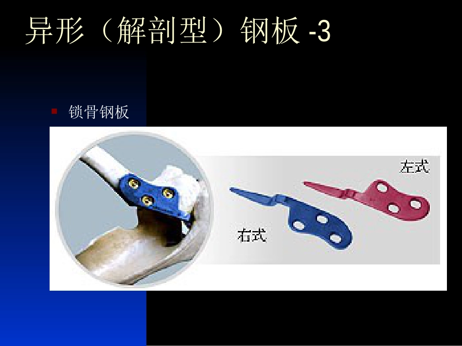 外科学：骨科常用内固定器械_第12页