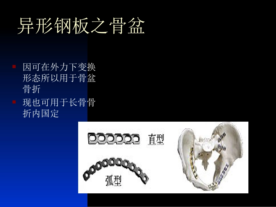 外科学：骨科常用内固定器械_第15页