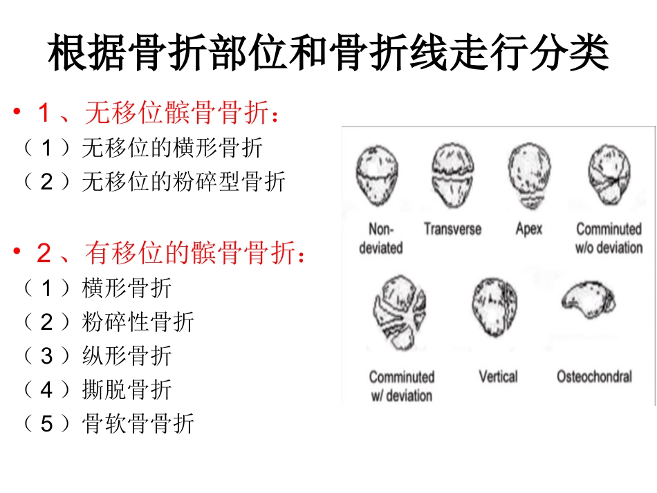 外科学：髌骨骨折_第6页