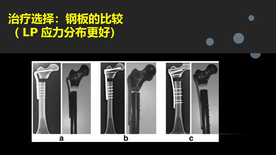 外科学：股骨粗隆下骨折_第12页