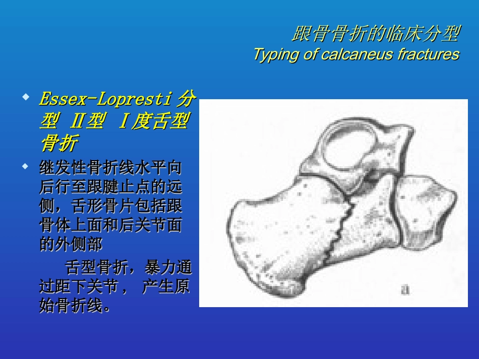 外科学：跟骨骨折的分型与治疗_第13页