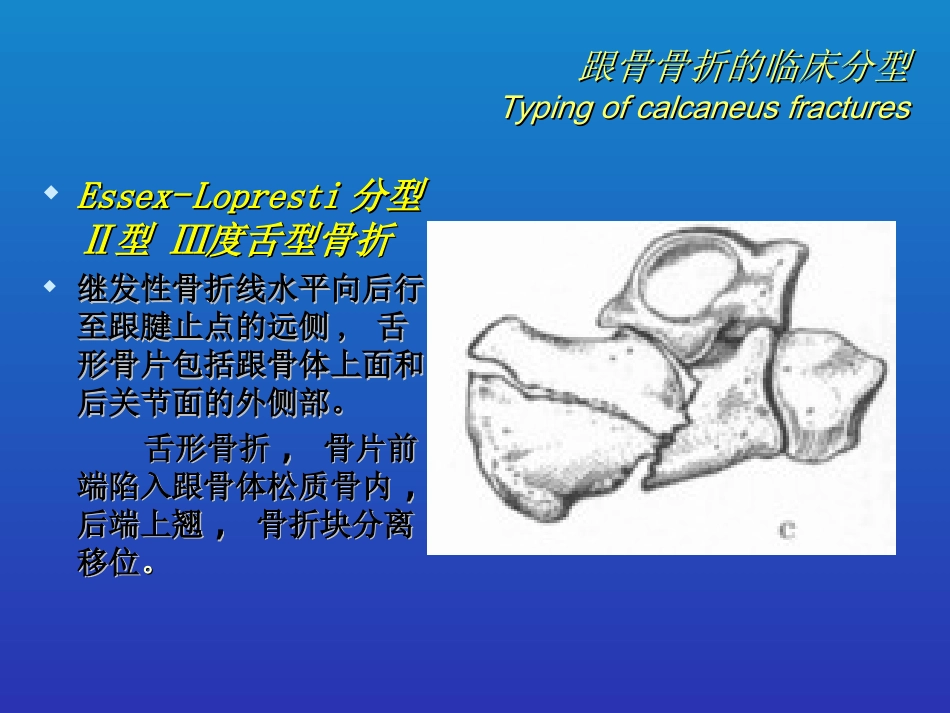 外科学：跟骨骨折的分型与治疗_第15页
