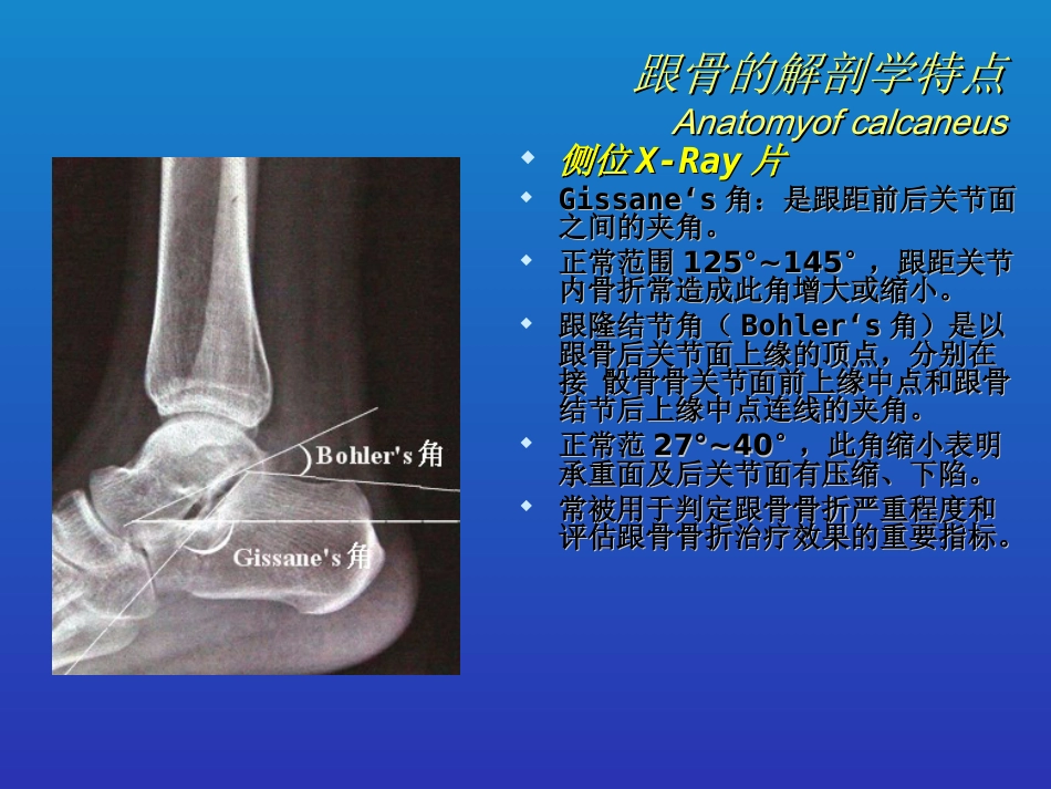 外科学：跟骨骨折的分型与治疗_第3页