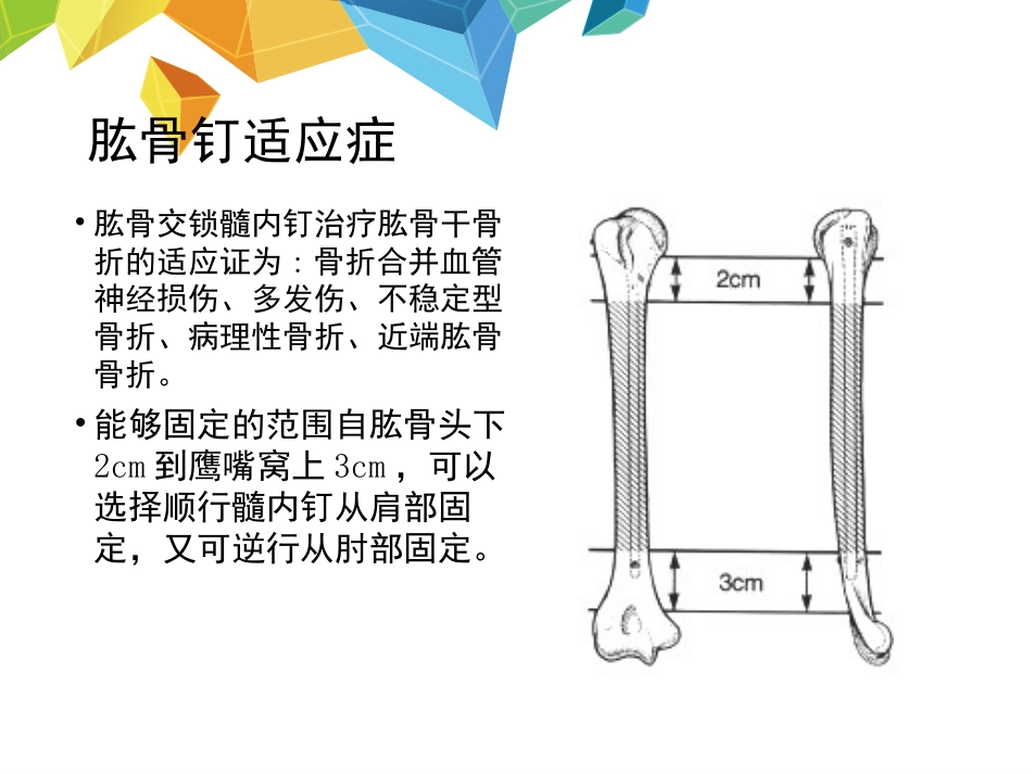 外科学：髓内钉应用的基本原则_第11页