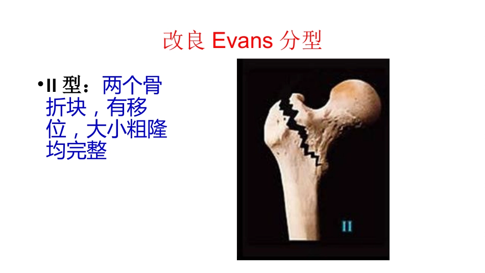 外科学：股骨粗隆间分型_第10页