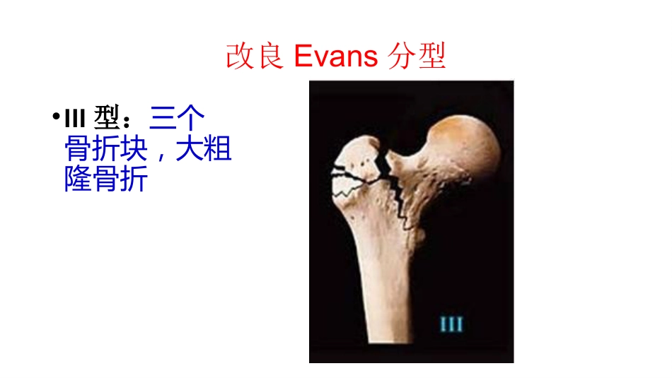 外科学：股骨粗隆间分型_第11页