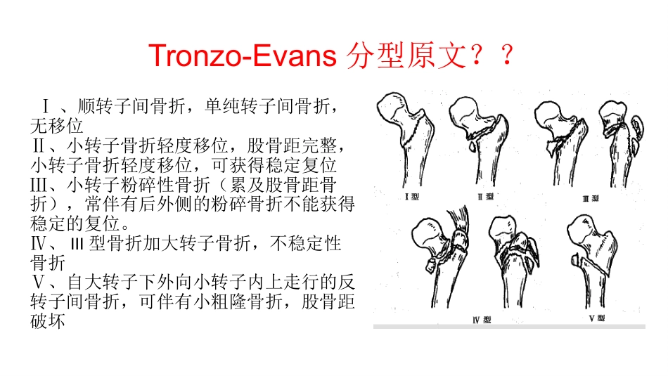 外科学：股骨粗隆间分型_第15页