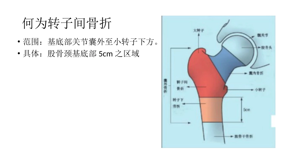 外科学：股骨粗隆间分型_第2页