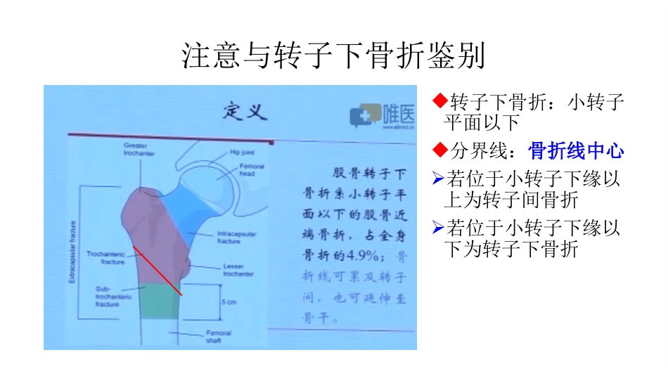 外科学：股骨粗隆间分型_第3页