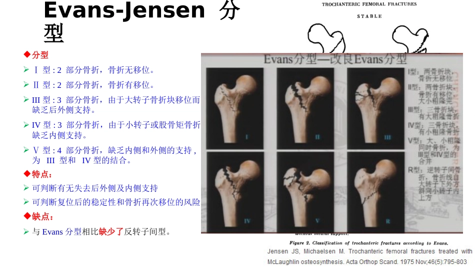 外科学：股骨粗隆间分型_第8页