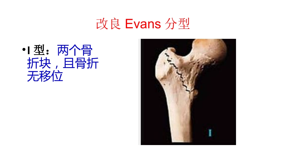 外科学：股骨粗隆间分型_第9页