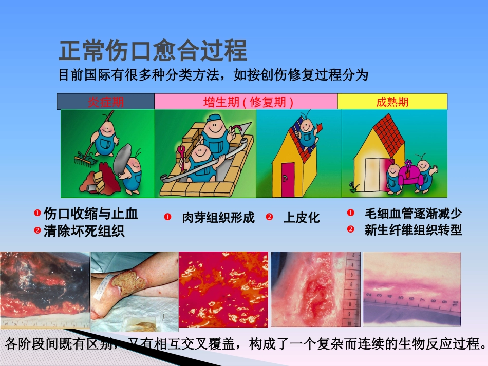 临床医学伤口湿性愈合理论及临床应用_第4页