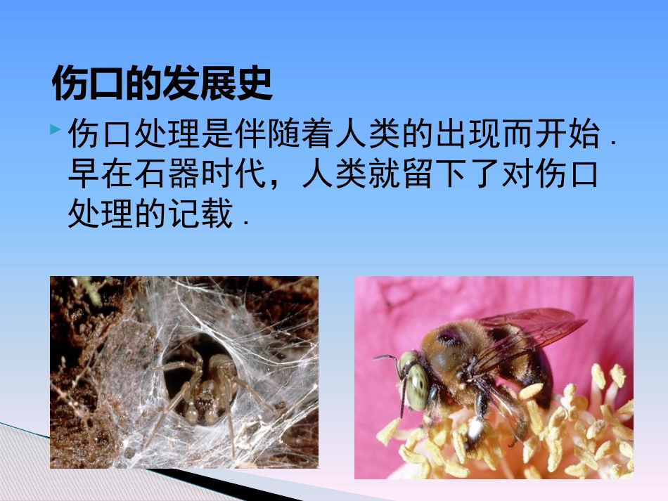 临床医学伤口湿性愈合理论及临床应用_第5页