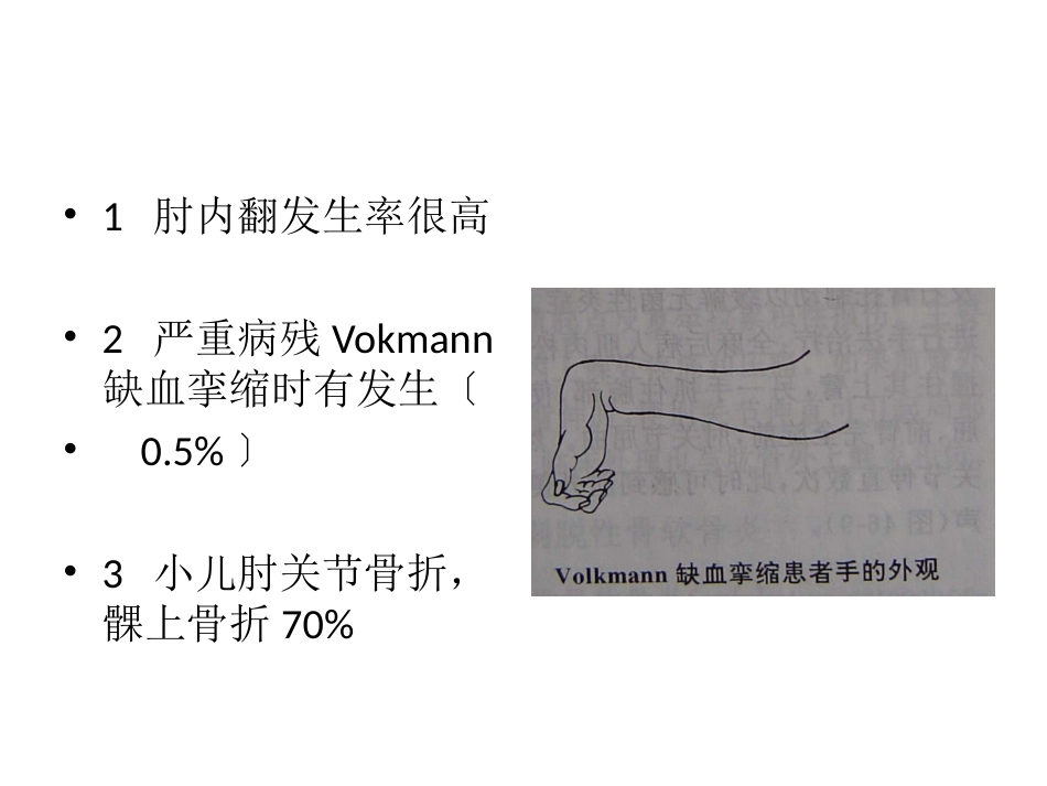 外科学：小儿肱骨髁上骨折_第4页
