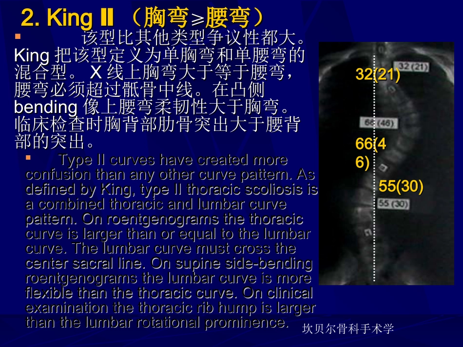 外科学：青少年特发性脊柱侧弯的分型_第15页
