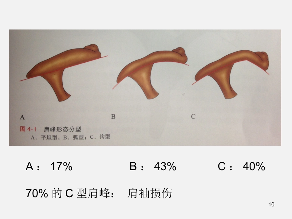 外科学：肩袖损伤诊断与治疗_第10页