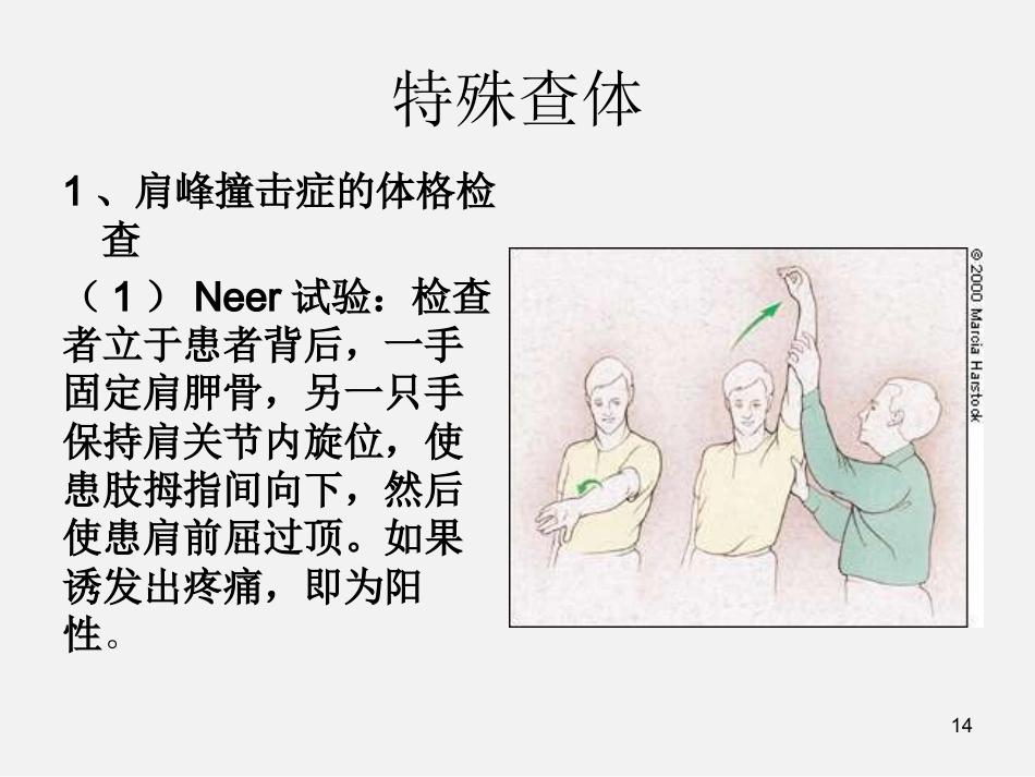 外科学：肩袖损伤诊断与治疗_第14页