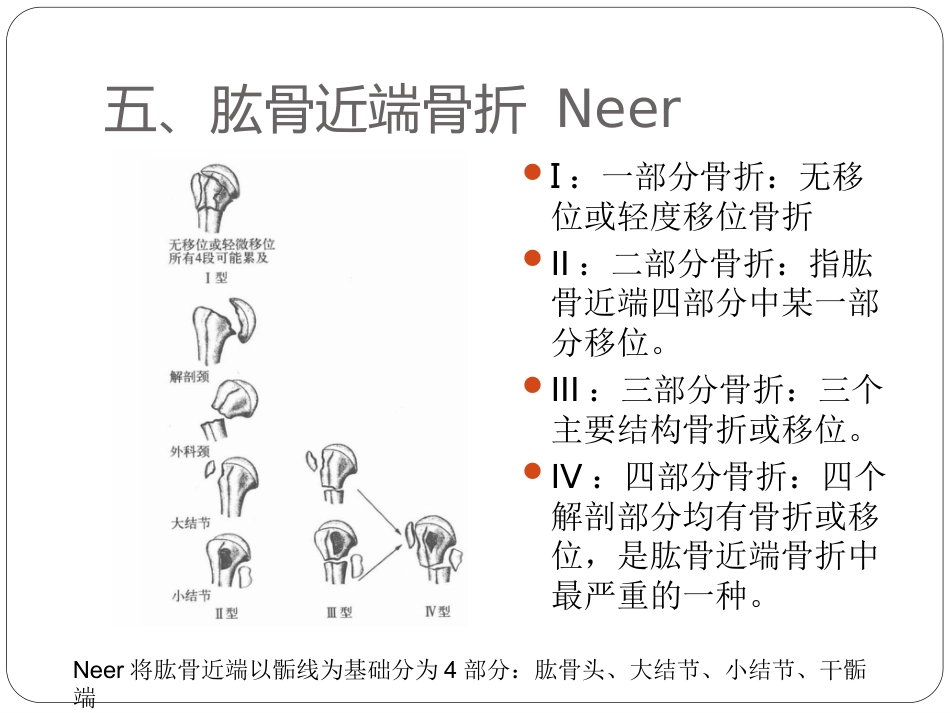 外科学：骨与关节骨折分型_第10页