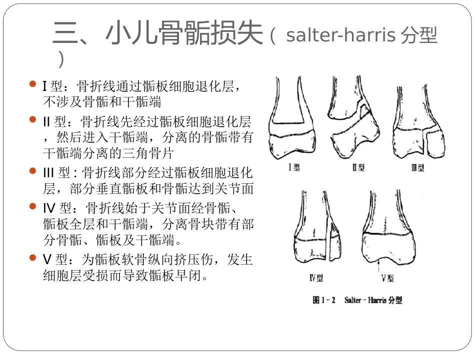 外科学：骨与关节骨折分型_第6页