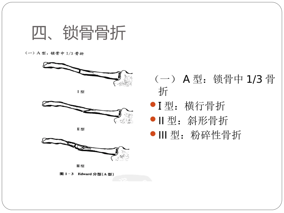 外科学：骨与关节骨折分型_第7页