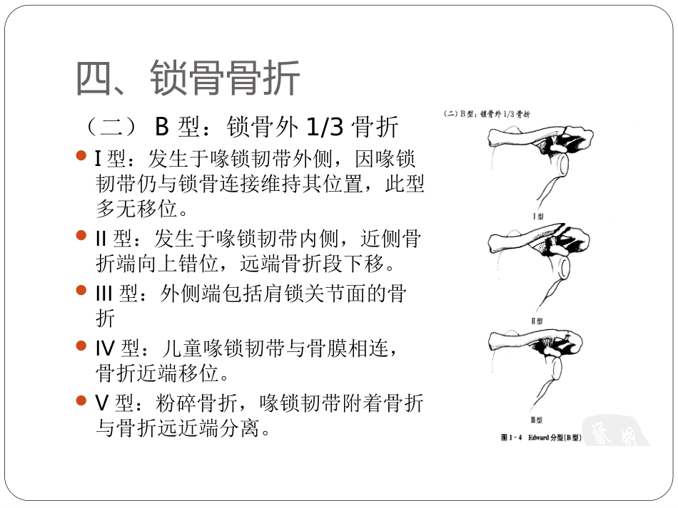 外科学：骨与关节骨折分型_第8页