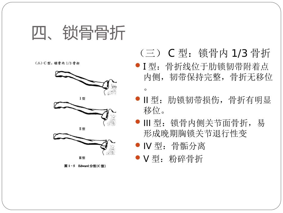 外科学：骨与关节骨折分型_第9页