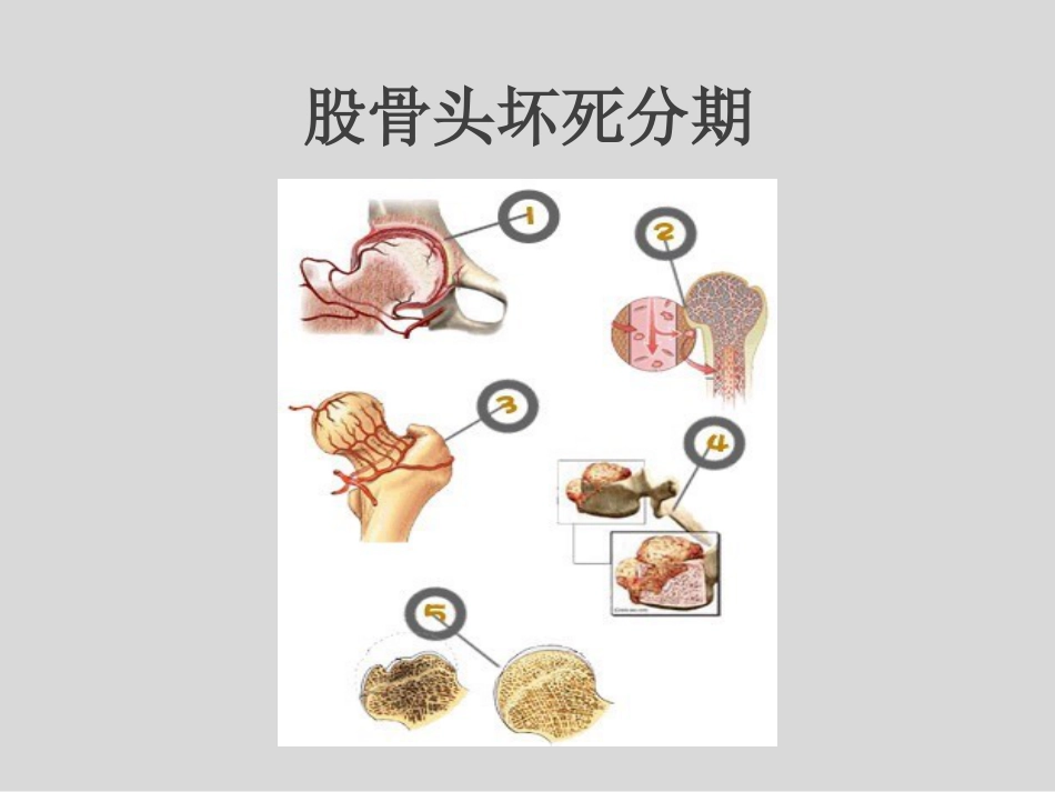 外科学：冲击波疗法治疗股骨头坏死_第8页