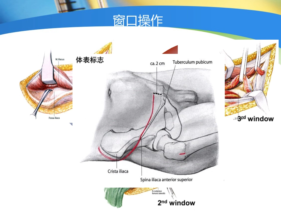 外科学：骨盆髋臼入路选择_第12页