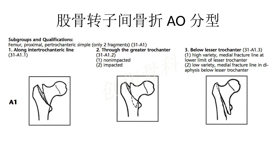 外科学：股骨转子间骨折的复位难点及对策_第2页