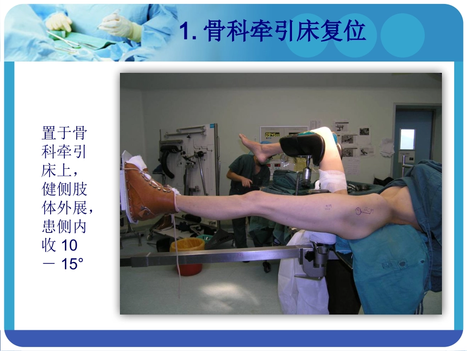 外科学：PFNA在股骨粗隆间骨折的应用_第15页