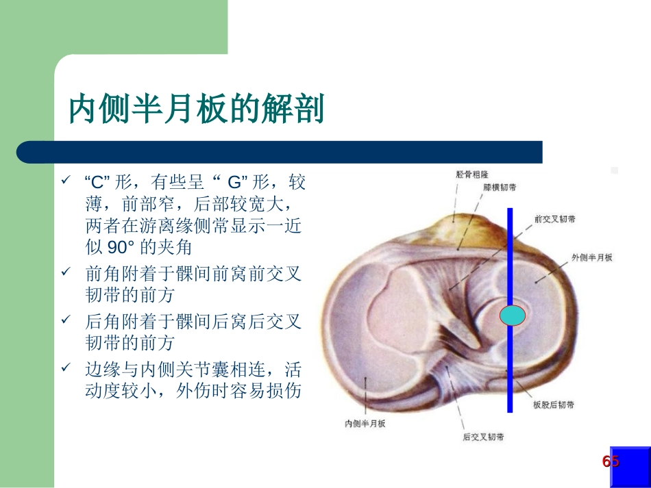 外科学：膝关节半月板损伤MRI诊断(ppt)_第2页