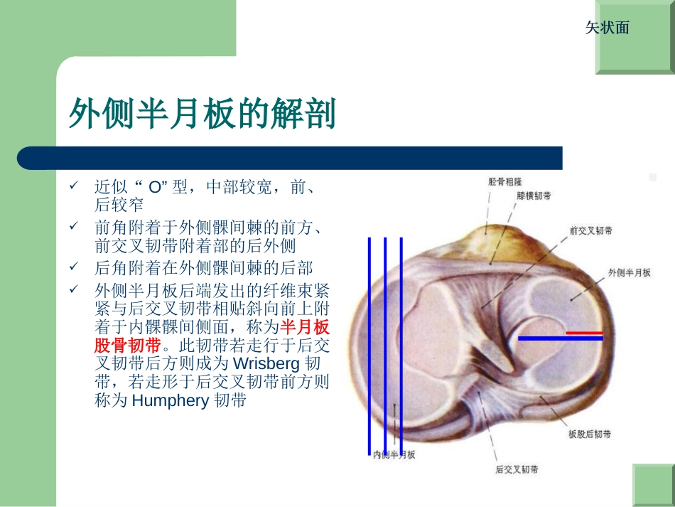 外科学：膝关节半月板损伤MRI诊断(ppt)_第3页