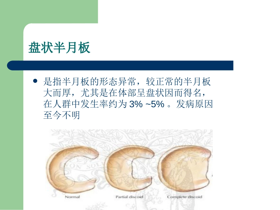 外科学：膝关节半月板损伤MRI诊断(ppt)_第4页
