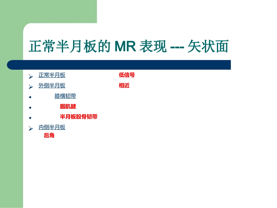 外科学：膝关节半月板损伤MRI诊断(ppt)_第6页