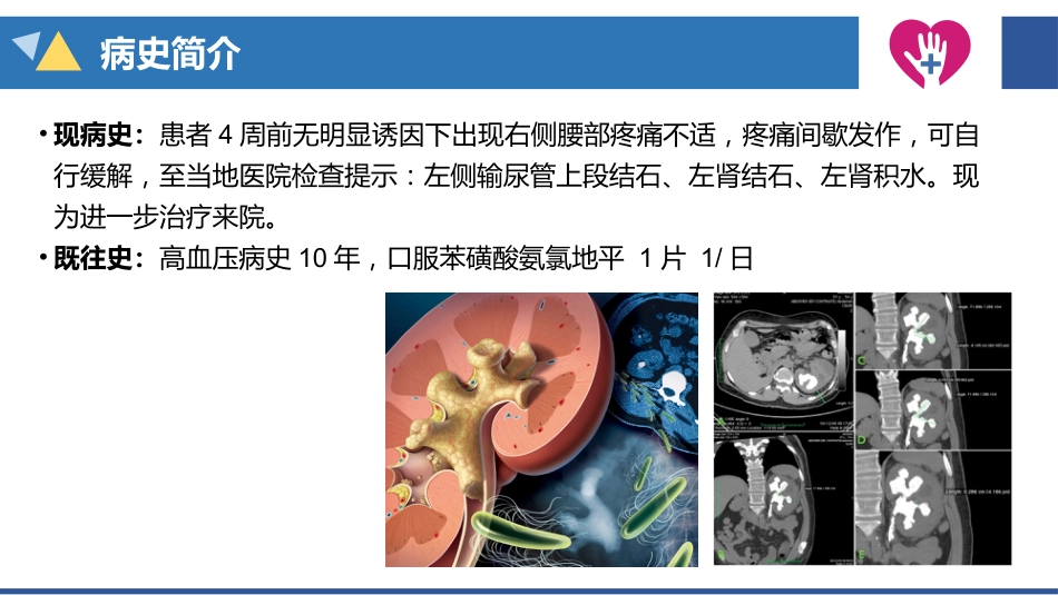 经皮肾镜碎石术手术配合_第12页