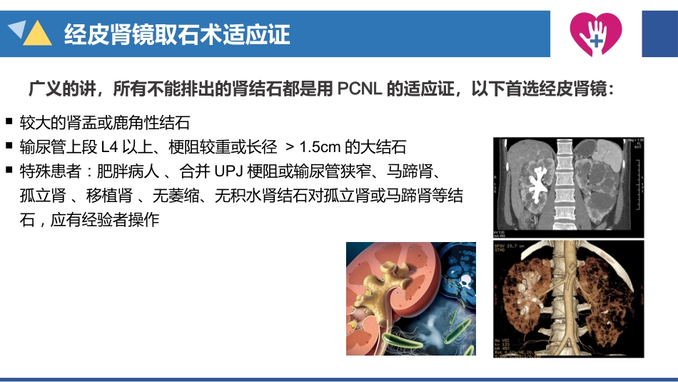 经皮肾镜碎石术手术配合_第8页