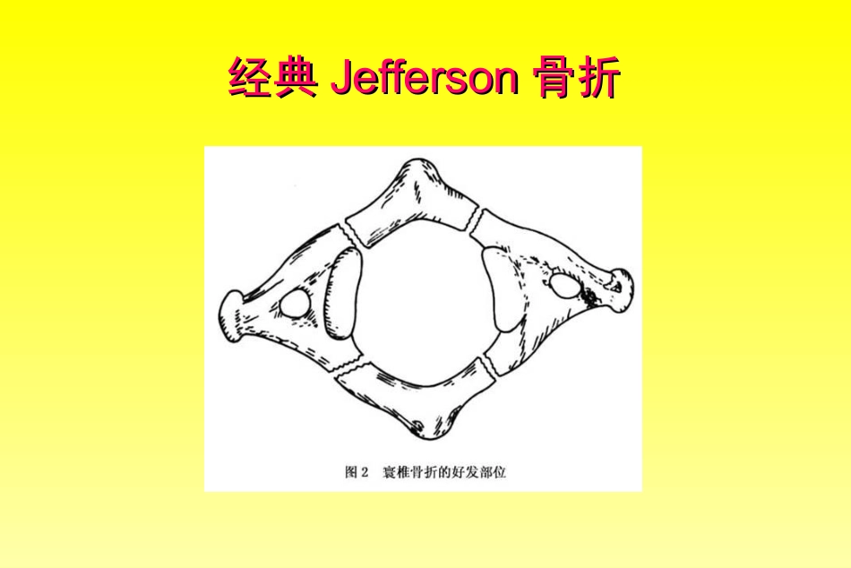 外科学：颈椎骨折分型_第6页