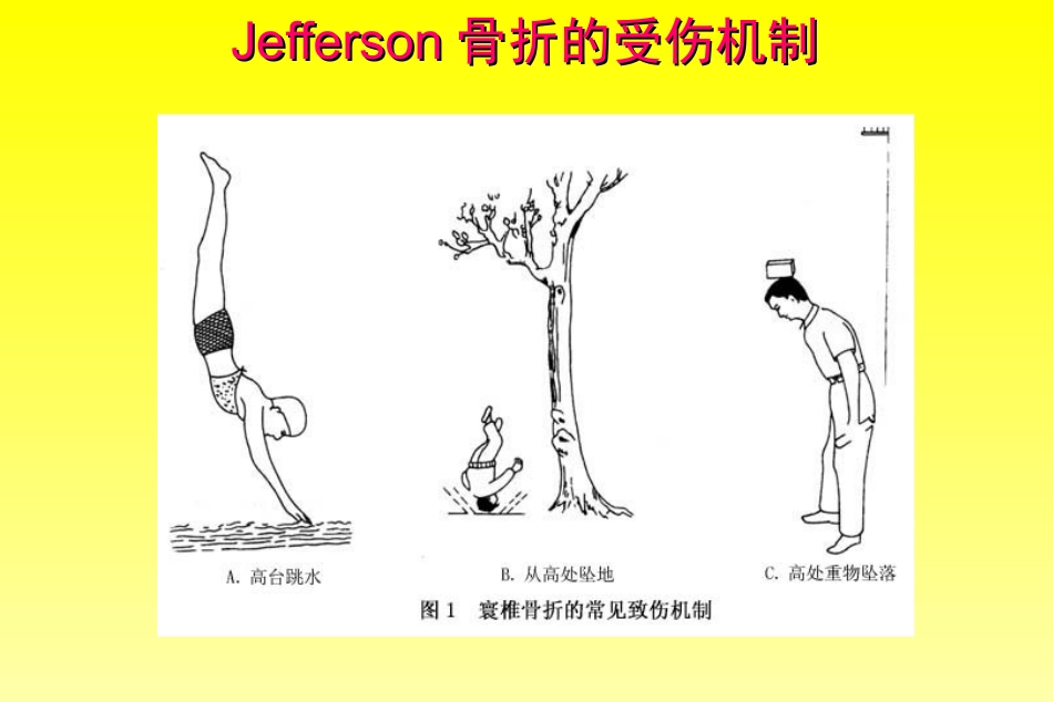 外科学：颈椎骨折分型_第7页