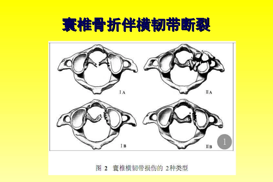 外科学：颈椎骨折分型_第9页