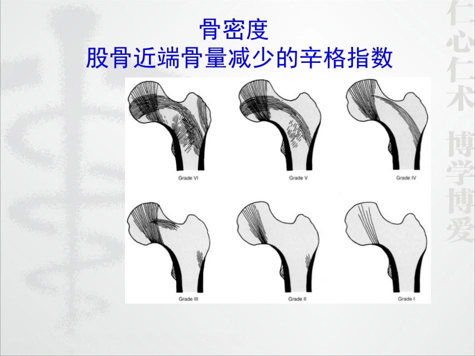 外科学：股骨颈骨折的诊断和治疗翻译_第4页