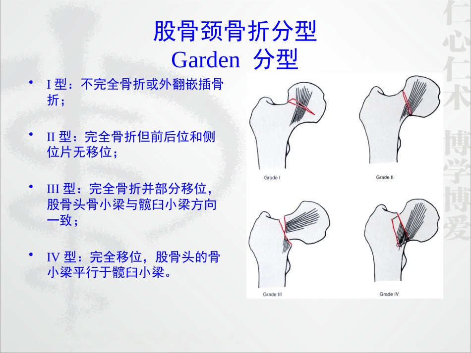外科学：股骨颈骨折的诊断和治疗翻译_第6页