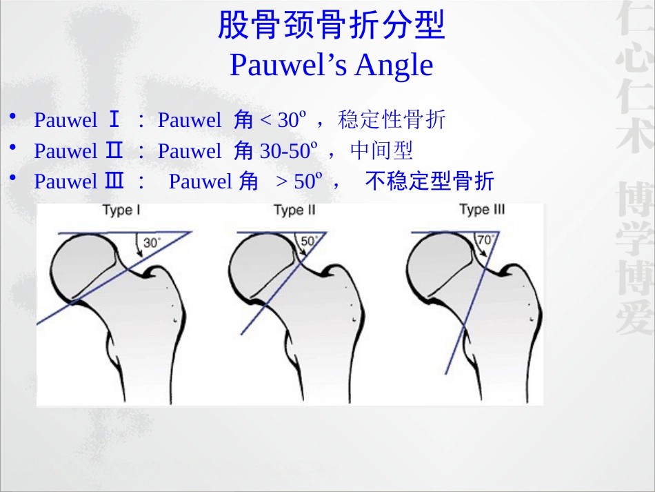 外科学：股骨颈骨折的诊断和治疗翻译_第7页