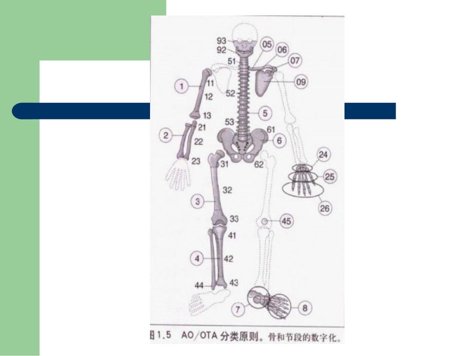 外科学：骨折分型_第5页